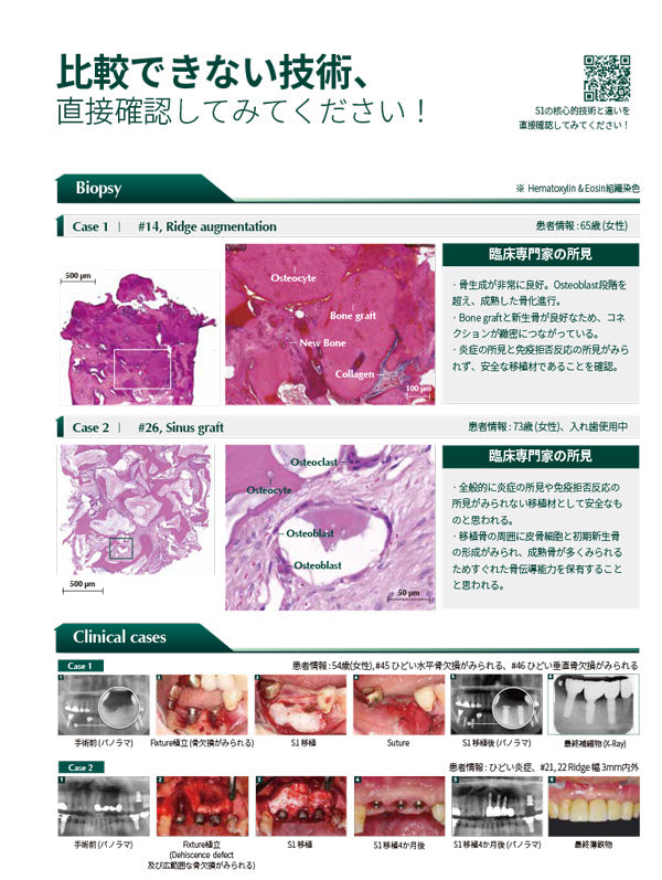 S1 ボーン 2.0cc (0.2ｍｍ-1.0ｍｍ)
